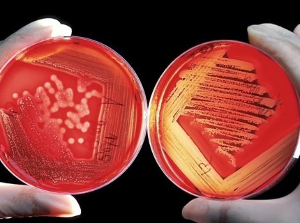 Bacillus subtilis vs. Bacillus clausii